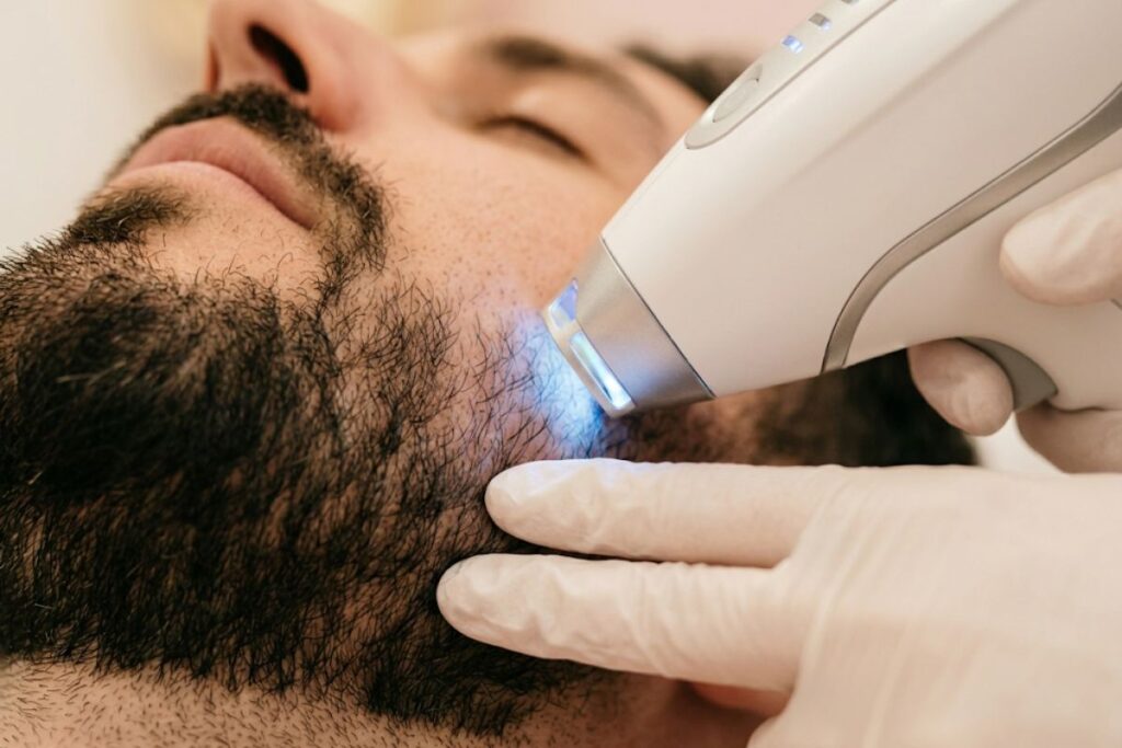 cuántas sesiones de depilación láser son necesarias para la barba